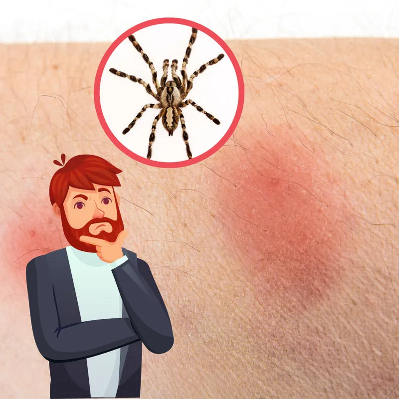 15549 tarantula first aid