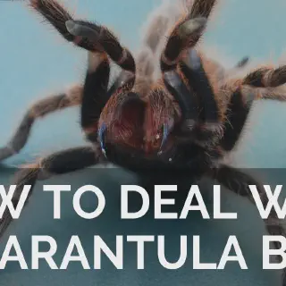 /img/15559-tarantula-bite-medical-attention.webp