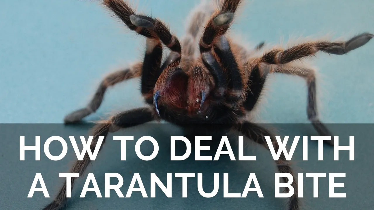 15761 tarantula bite first aid
