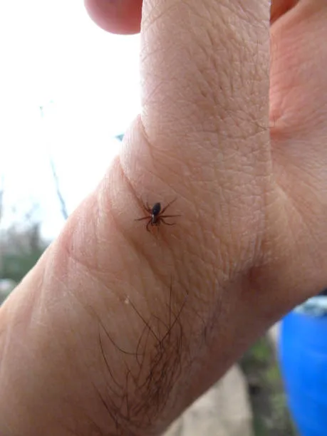 15875 allergic reaction tarantula